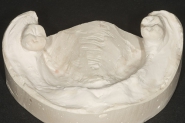 15-lower-denture-model