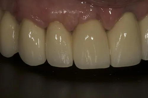 2 week review up close right hand side