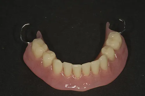 New lower denture made to match upper