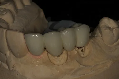 Permanent bridge made and shown on model