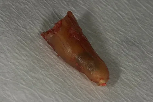 Split tooth root
